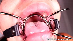 Mouth Gag Close Up - Brat Perversions Thumb